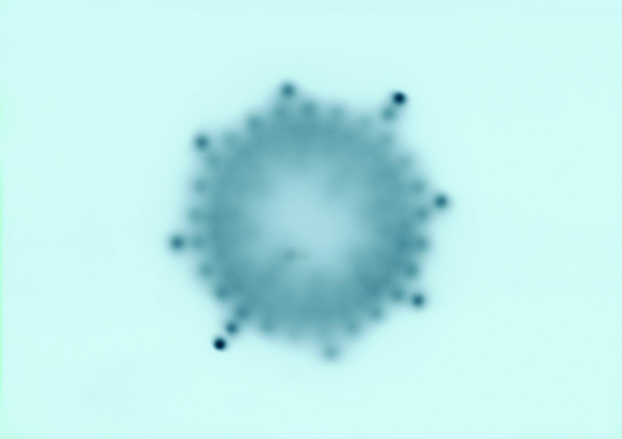 Autoradiograph